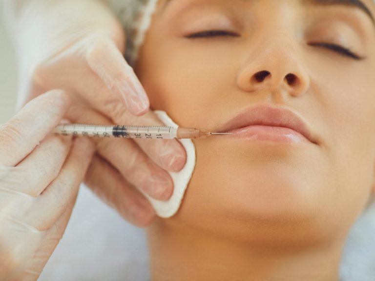 Lip Fillers Scottsdale